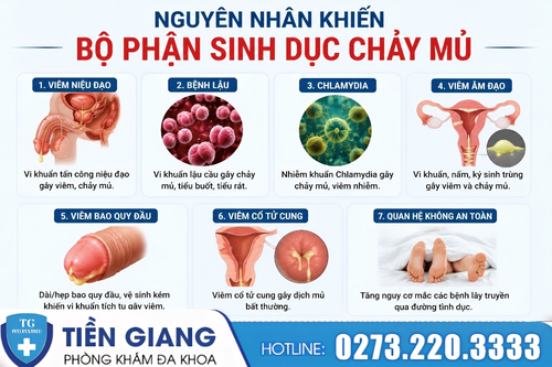 Nguyên nhân khiến bộ phận sinh dục bị chảy mủ.